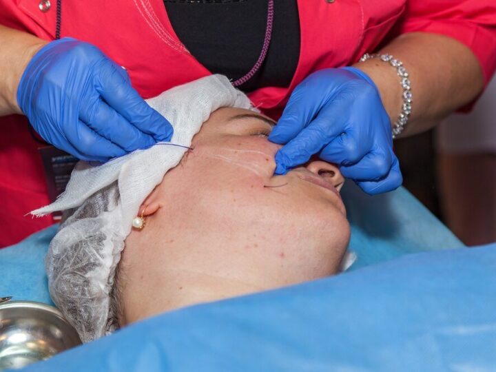 Leczenie żółtaków i usuwanie kępek żółtych z powiek