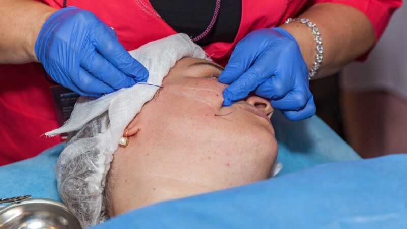 Leczenie żółtaków i usuwanie kępek żółtych z powiek