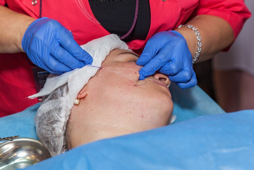 Leczenie żółtaków i usuwanie kępek żółtych z powiek